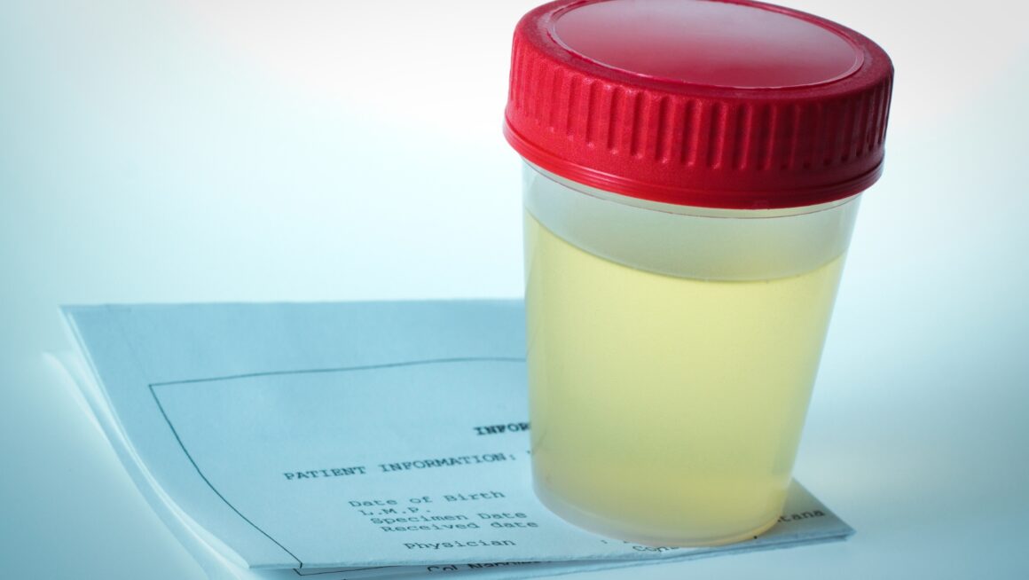 SAP 9/2000 w/NIT (Urine) - The Ultimate Guide to Drug Testing - Home ...